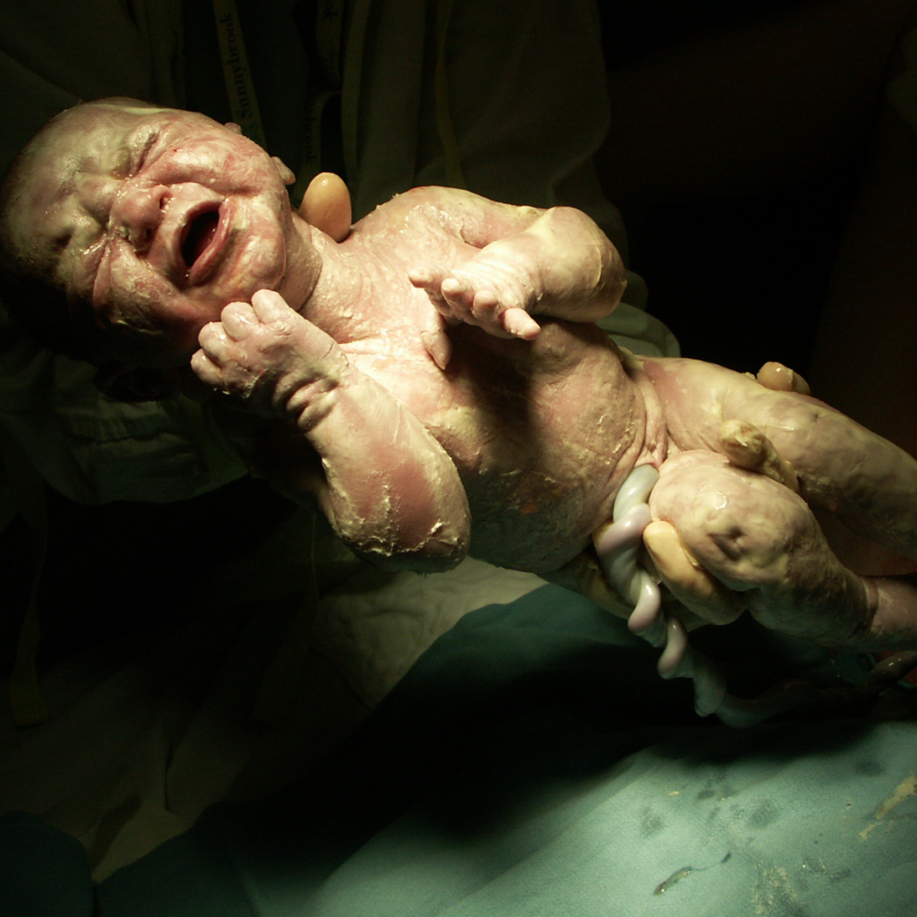 newborn baby with vernix coating