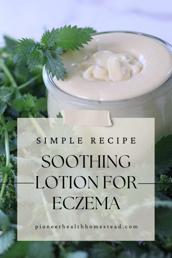 soothing nettle lotion for eczema Pin